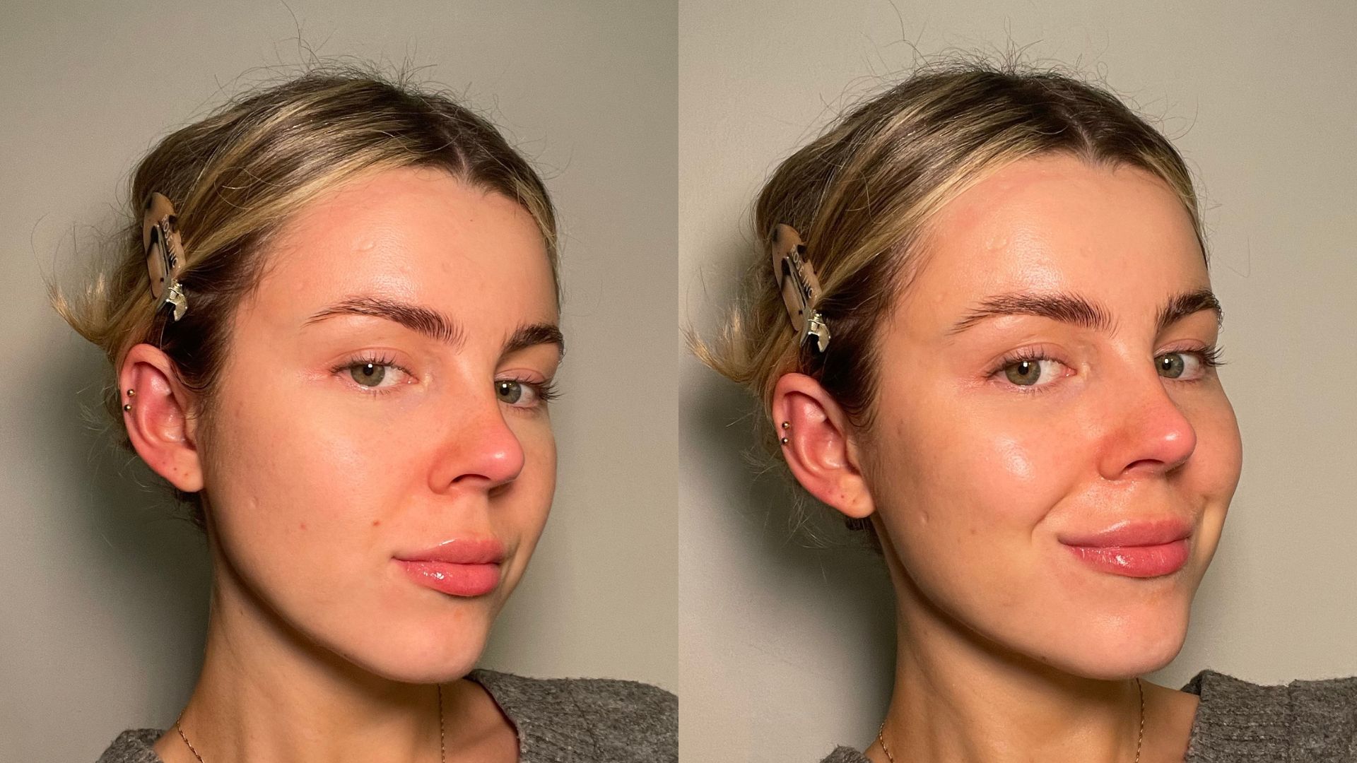 Elemis Pro Marine Collagen Cream Freya Before And After Elemis Pro Marine Collagen Cream Freya Before And After